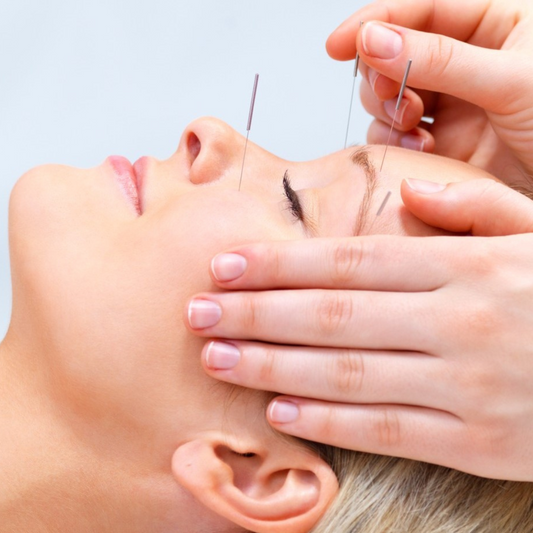 Facial Rejuvenation Workshop - Cosmetic Acupuncture June 2025