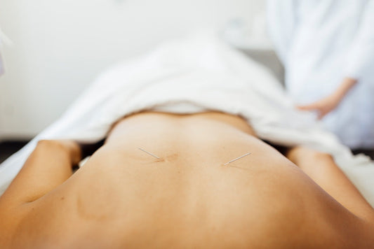Experience Our Acupuncture School — Free Student Clinic Session