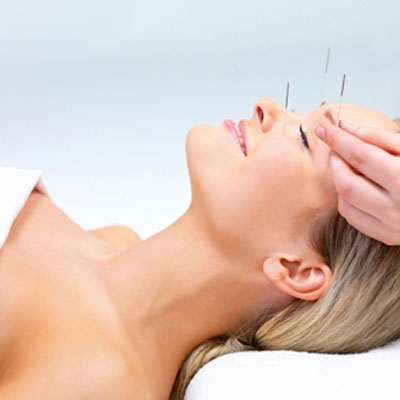 This Facial Rejuvenation course will allow acupuncturists to use basic principles of Traditional Chinese Medicine to do a cosmetic acupuncture treatment.